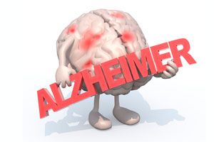 Ilustración de Cómo Prevenir el Alzheimer