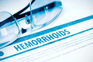 Ilustración de Cómo tratar las Hemorroides Naturalmente