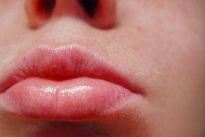 Remedios caseros para labios resecos