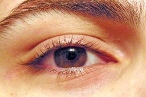 Ilustración de Cómo prevenir las arrugas en los ojos